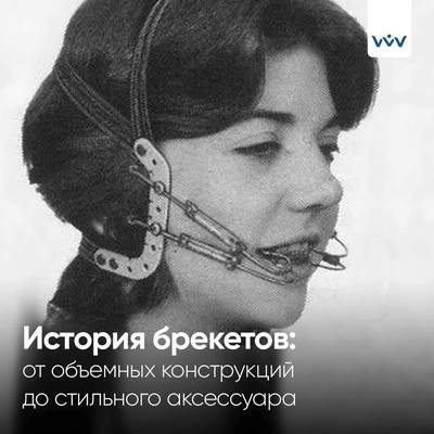 История брекетов: от мумий до Пьера Фошара.
